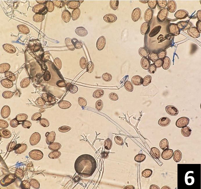 individual lemon-shaped sporangia 